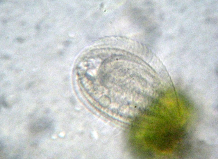 Protozoi del muschio: Phacodinium metchnicoffi ?